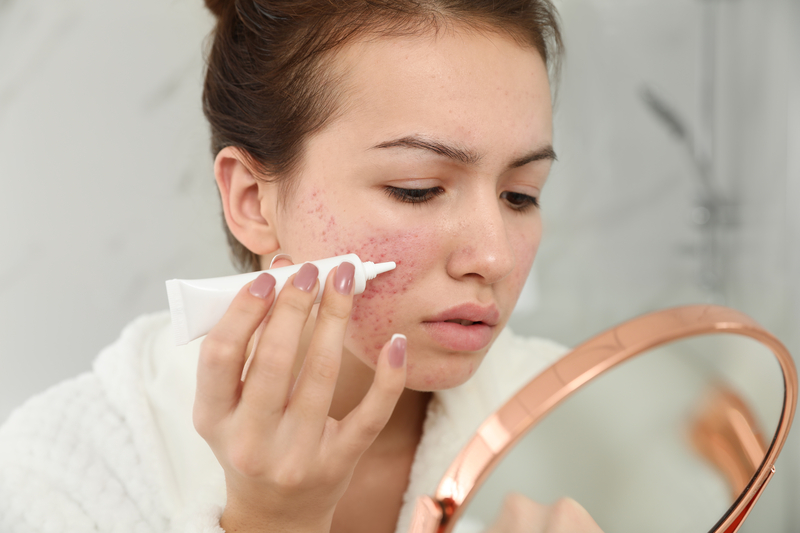 Teenage Girl Applying Cream To Help Heal Her Acne Faster